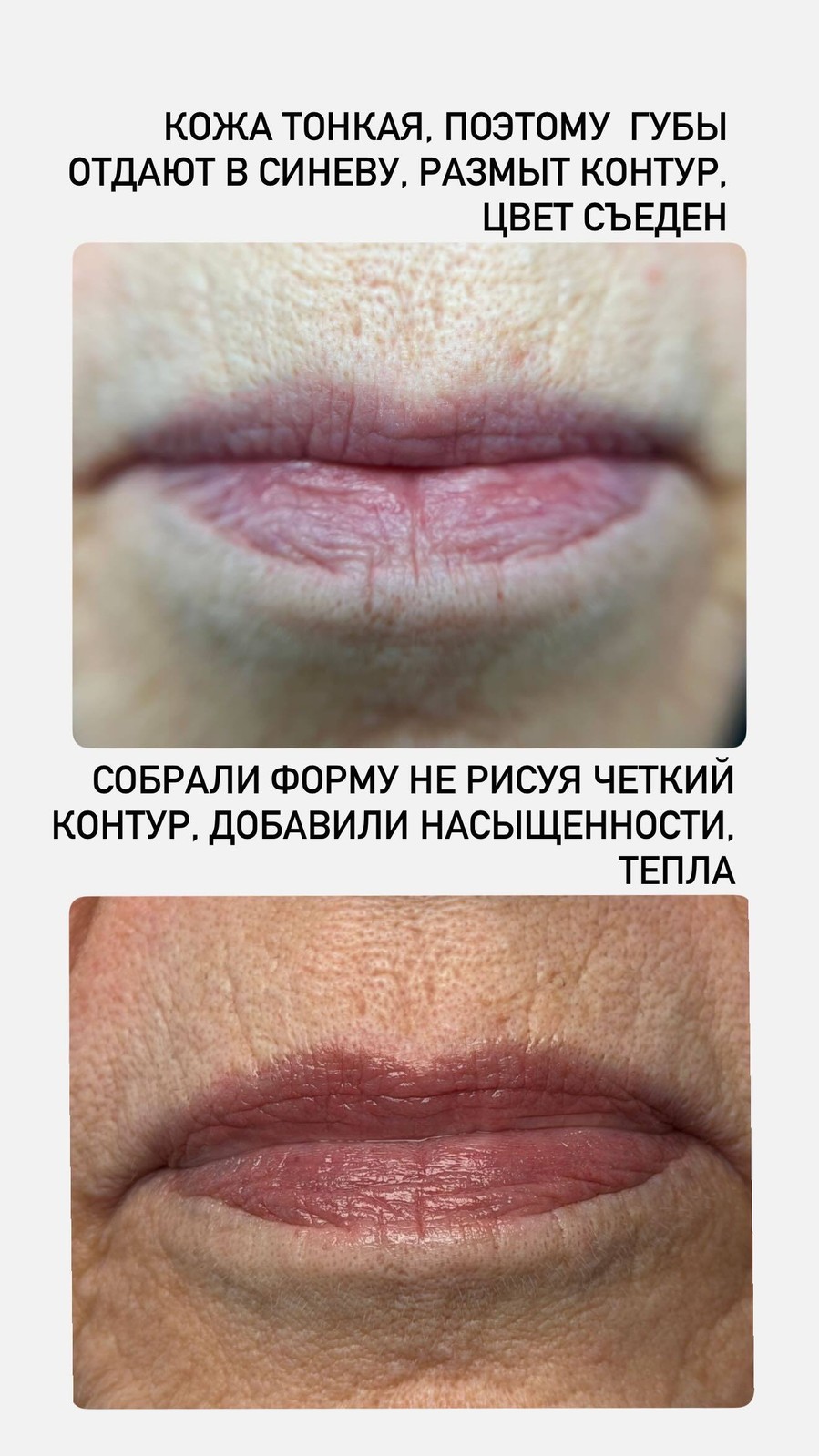 Кейс: тонкая кожа губ